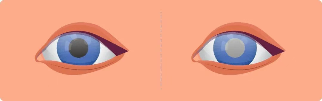 图片.png 图片.png